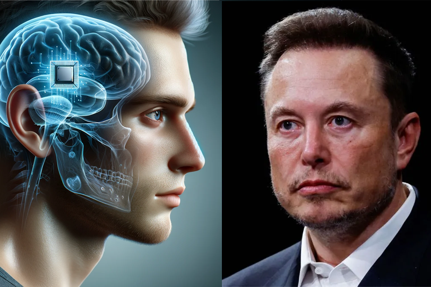 Elon Musk announced that Neuralink has implanted the first human brain chip